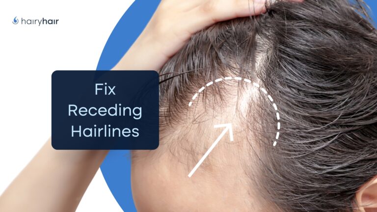 How To Treat Receding Hairlines