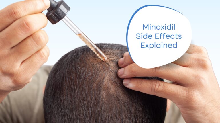Understanding Minoxidil Side Effects: Key Insights for Users