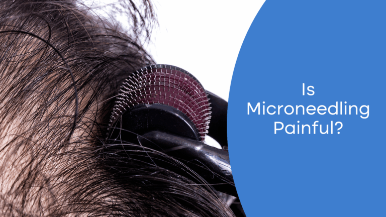 Does Microneedling Hurt? Your Questions Answered
