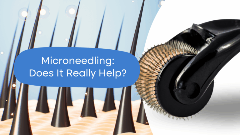 Does Microneedling Work? Our Experts Have Their Say