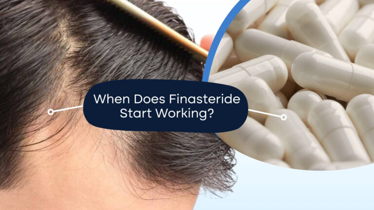 How Long Does Finasteride Take to Work?