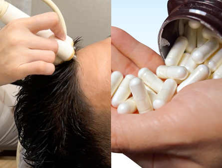 PEMF vs Dutasteride