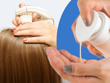 PEMF vs Hair Loss Shampoo