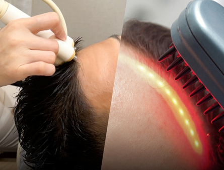 PEMF vs Laser Therapy