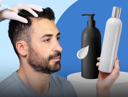 PRP vs Hair Loss Shampoo