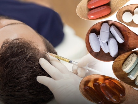 PRP vs Hair Vitamins