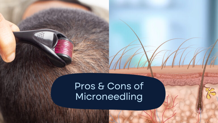 The Benefits of Microneedling: Pros, Cons, & Risks