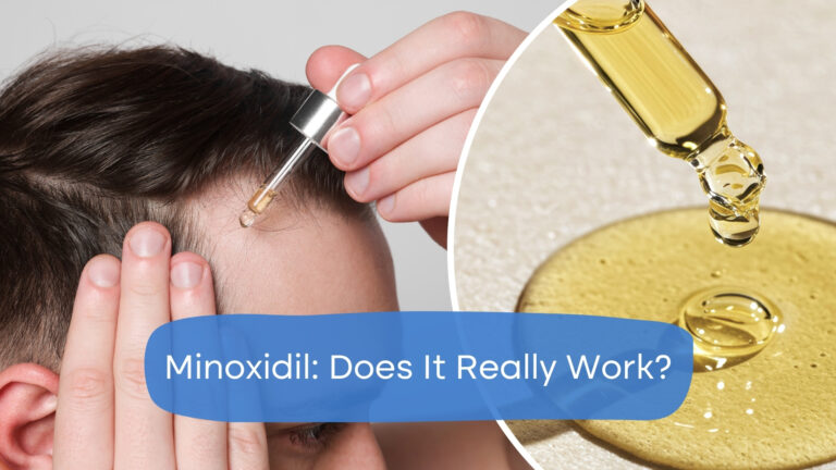 Does Minoxidil Work? Our Experts Explain