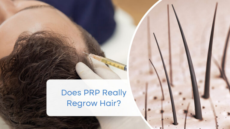 PRP and Hair Loss: Does This Treatment Really Work?