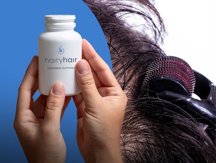 Hair Gummies vs Microneedling