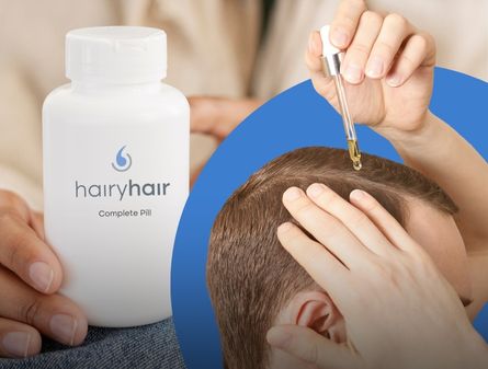 Hair Gummies vs Minoxidil