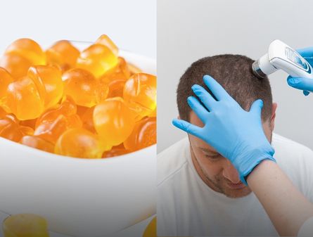 Hair Gummies vs PEMF