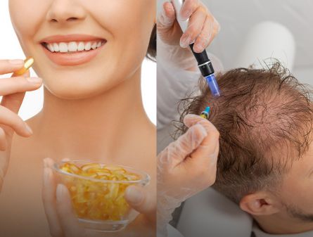 Hair Gummies vs PRP