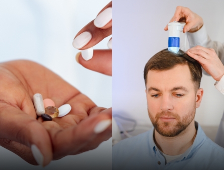 Hair Pills vs PEMF