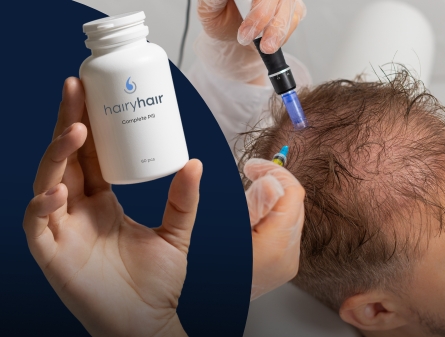 Hair Growth Pills vs PRP
